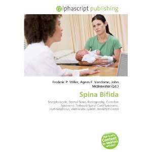  Spina Bifida (9786134062282) Books
