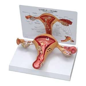  Uterus Model