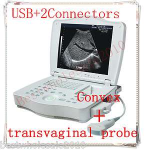 CE FDA Laptop Ultrasound Scanner Machine with convex+transvaginal 