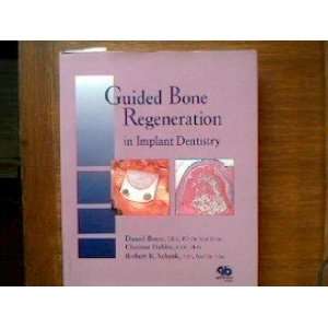   Regeneration in Implant Dentistry (9780867152494) Daniel Buser Books