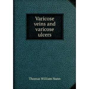    Varicose veins and varicose ulcers Thomas William Nunn Books